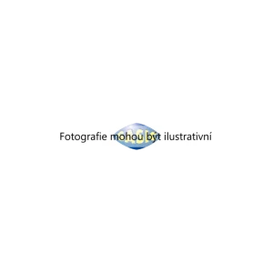 Zarážka, odpružení (SASIC 2656067) 7959291 Zarážka, odpružení (SASIC 2656067) 7959291